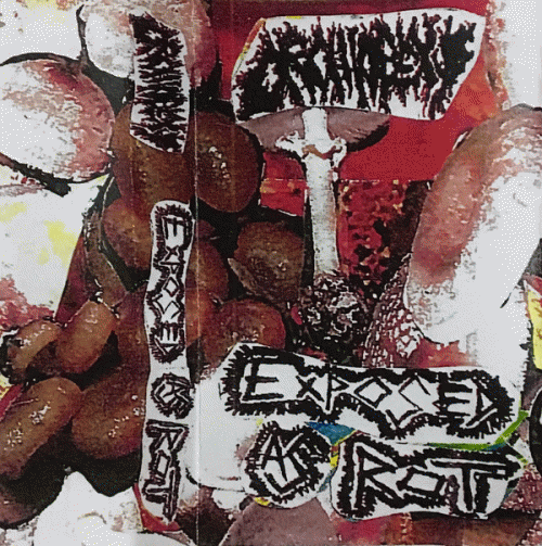 Exposed As Rot : Orchiopexy - Exposed As Rot